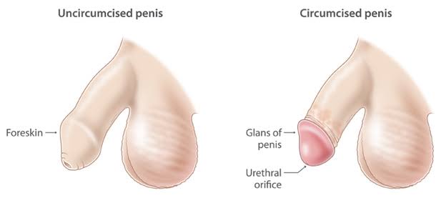Circumcised and uncircumcised Penis